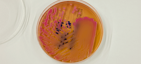 Bacillus cereus Sayımı